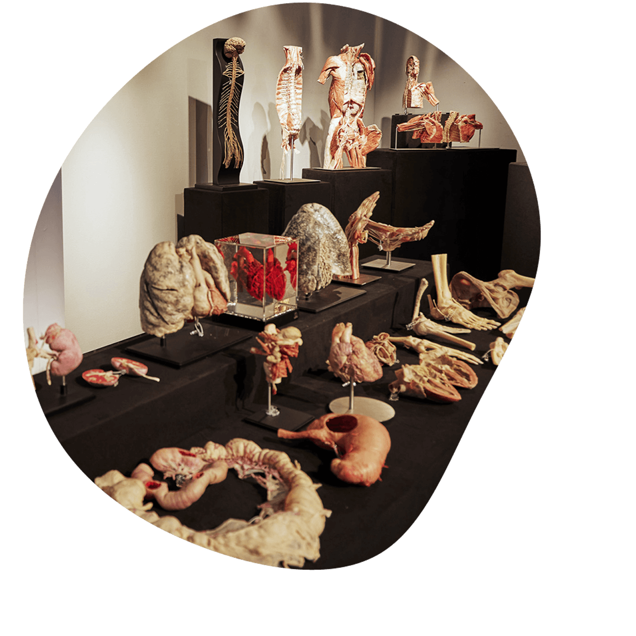 A variety of plastinated human specimens laid out on a table with a black cloth