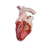 Human heart silicone plastinate for anatomy education from Anatomic Excellence and von Hagens Plastination