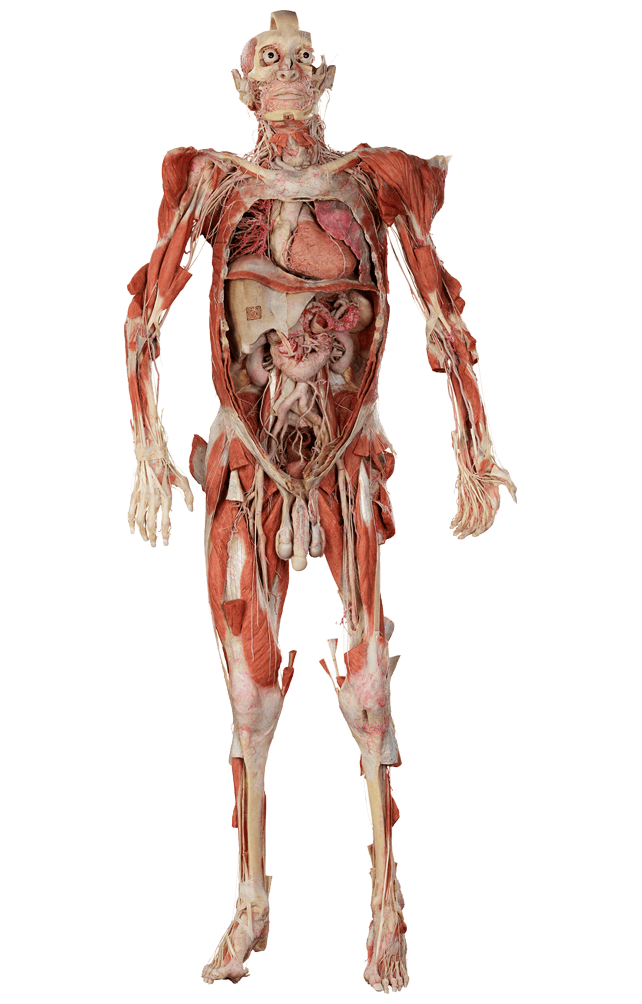 Male human body silicone plastinate available for anatomy education and training from Anatomic Excellence and von Hagens Plastination