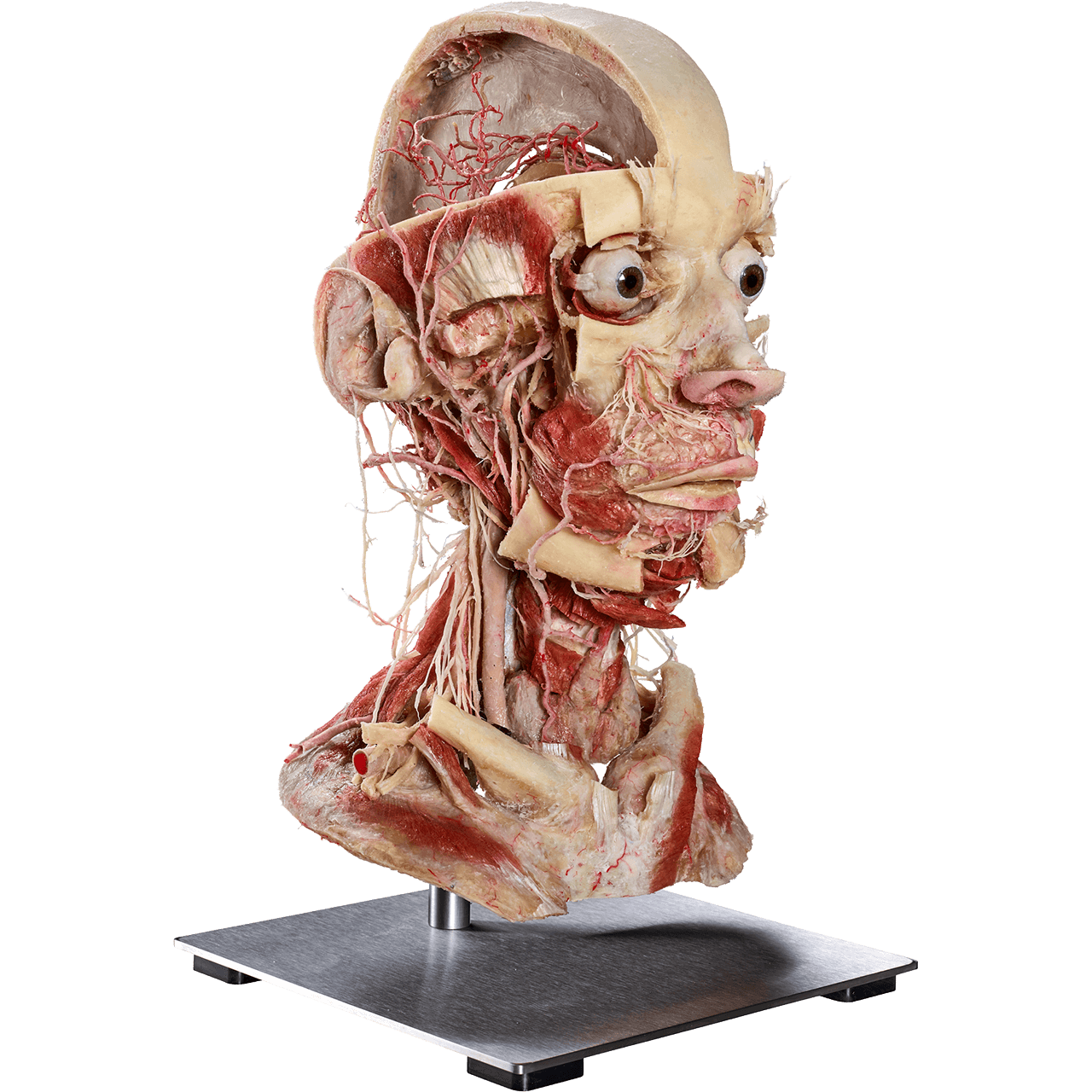 Plastinated human head and neck from Anatomic Excellence and von Hagens Plastination